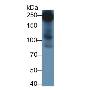 Chondroitin Sulfate Proteoglycan 4 (CSPG4) Human Polyclonal Antibody