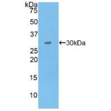 Mitogen Activated Protein Kinase Kinase Kinase Kinase 5 (MAP4K5) Human Polyclonal Antibody