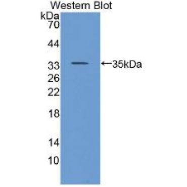 Cluster Of Differentiation 24 (CD24) Human Polyclonal Antibody