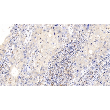 Sialic Acid Binding Ig Like Lectin 2 (CD22) Human Polyclonal Antibody