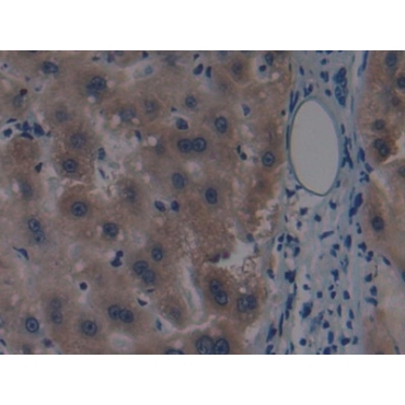 Mitogen Activated Protein Kinase Kinase Kinase 1 (MAP3K1) Human Polyclonal Antibody