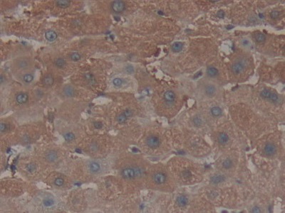 Nucleoporin 153 (NUP153) Human Polyclonal Antibody