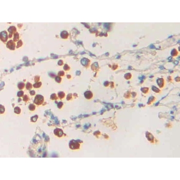 Phospholipase A1 (PLA1) Human Polyclonal Antibody