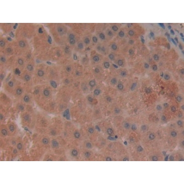 Leukocyte Immunoglobulin Like Receptor Subfamily B, Member 2 (LILRB2) Human Polyclonal Antibody