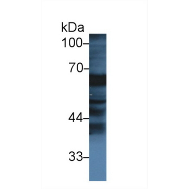 Fibrinogen Alpha Chain (FGA) Bovine (Cattle) Polyclonal Antibody