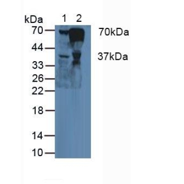 Fibrinogen Alpha Chain (FGA) Human Polyclonal Antibody