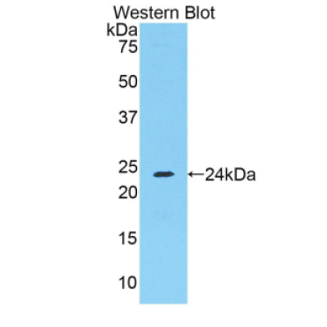 Fibrinogen Alpha Chain (FGA) Mouse Polyclonal Antibody
