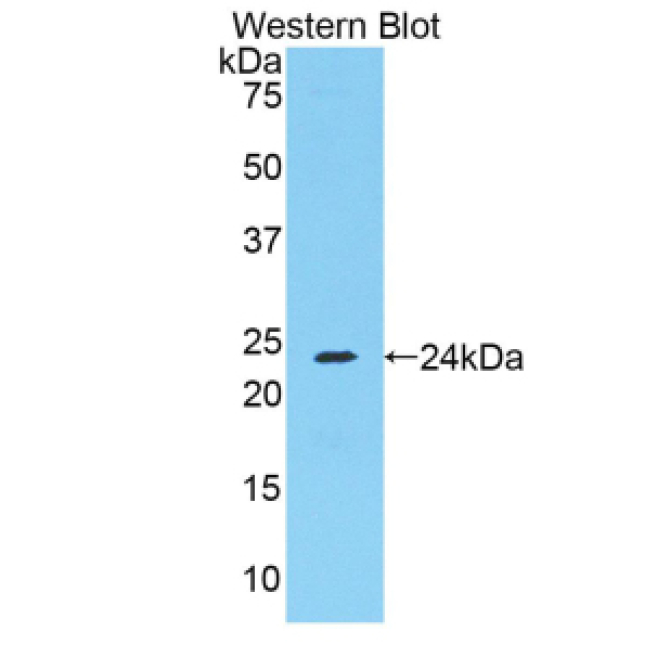 Fibrinogen Alpha Chain (FGA) Mouse Polyclonal Antibody