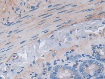 c-Jun N-terminal Kinase 1 (JNK1) Rat Polyclonal Antibody