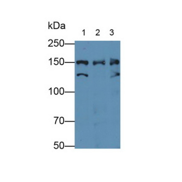 Nucleoporin 155 (NUP155) Human Polyclonal Antibody