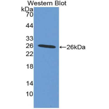 Integrin Alpha X (CD11c) Human Polyclonal Antibody