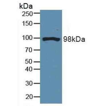 Dynamin 2 (DNM2) Human Polyclonal Antibody