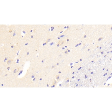 Androgen Induced Protein 1 (AIG1) Human Polyclonal Antibody