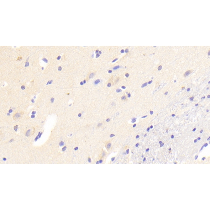 Androgen Induced Protein 1 (AIG1) Human Polyclonal Antibody