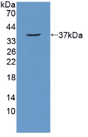 Nucleoporin 214kDa (NUP214) Mouse Polyclonal Antibody