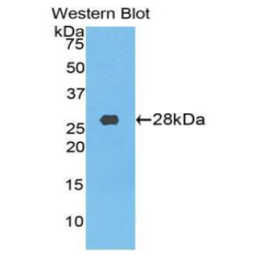 Transferrin Receptor (TFR) Chicken (Gallus) Polyclonal Antibody