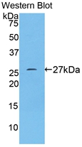 Transferrin Receptor (TFR) Human Polyclonal Antibody