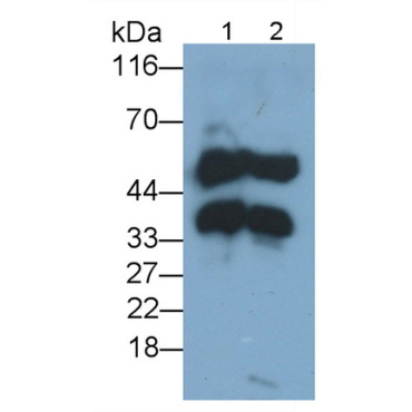 Clusterin (CLU) Human Polyclonal Antibody