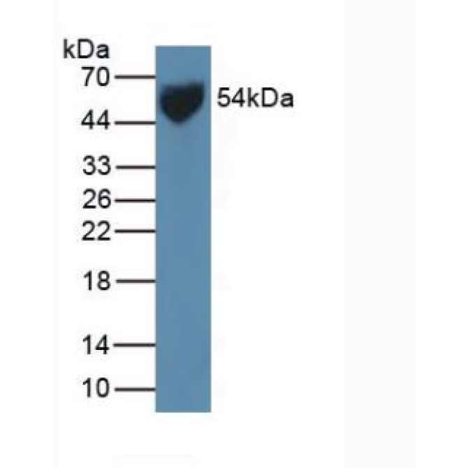 Glucose Transporter 1 (GLUT1) Human Polyclonal Antibody