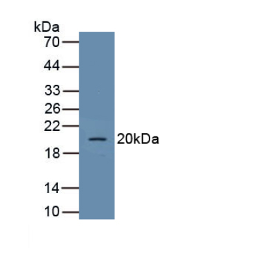 Glucose Transporter 1 (GLUT1) Human Polyclonal Antibody