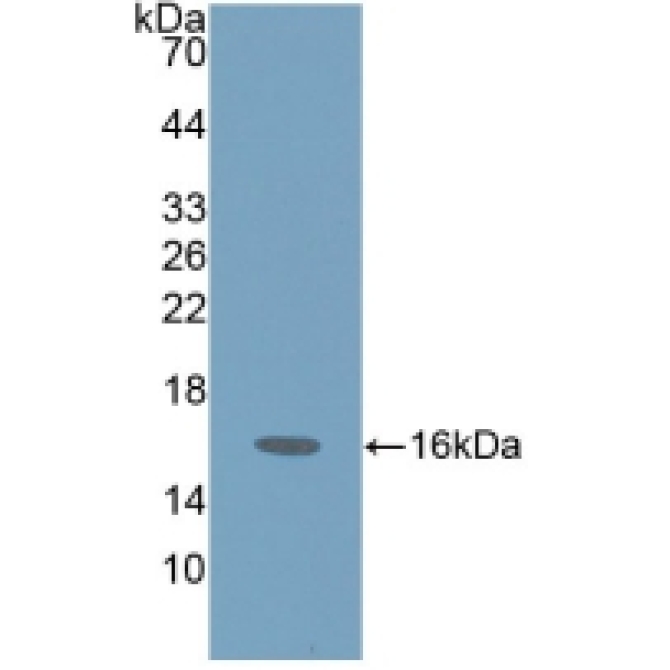 Pro-Gastrin Releasing Peptide (ProGRP) Human Polyclonal Antibody