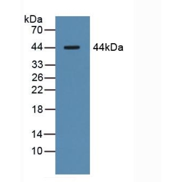 Asialoglycoprotein Receptor 1 (ASGR1) Human Polyclonal Antibody
