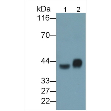 Asialoglycoprotein Receptor 1 (ASGR1) Mouse Polyclonal Antibody