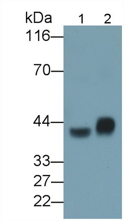 Asialoglycoprotein Receptor 1 (ASGR1) Mouse Polyclonal Antibody