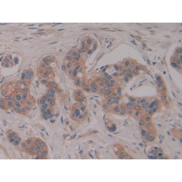 Pregnancy Specific Beta-1-Glycoprotein 1 (PSG1) Human Polyclonal Antibody