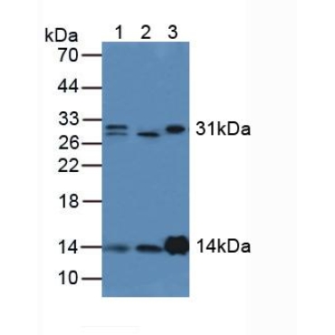 Lysozyme (LZM) Human Polyclonal Antibody