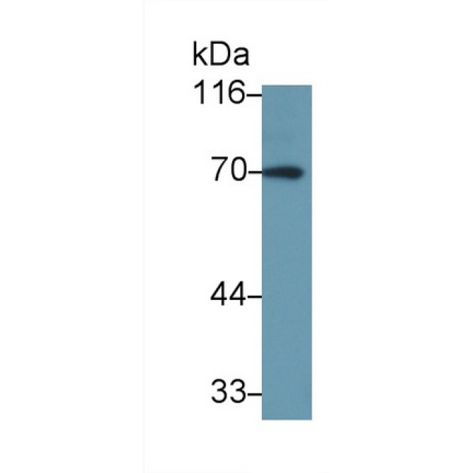 Interleukin 27 Receptor Alpha (IL27Ra) Human Polyclonal Antibody