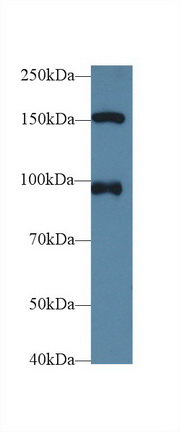 Nucleoporin 98 (NUP98) Human Polyclonal Antibody