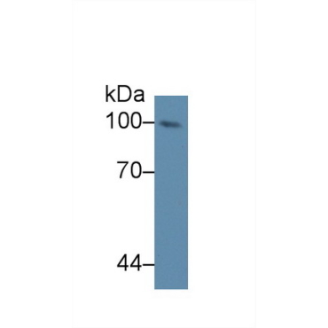 Nucleoporin 98 (NUP98) Mouse Polyclonal Antibody