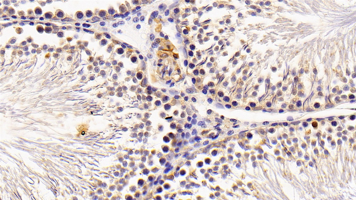 Cartilage Oligomeric Matrix Protein (COMP) Rat Polyclonal Antibody
