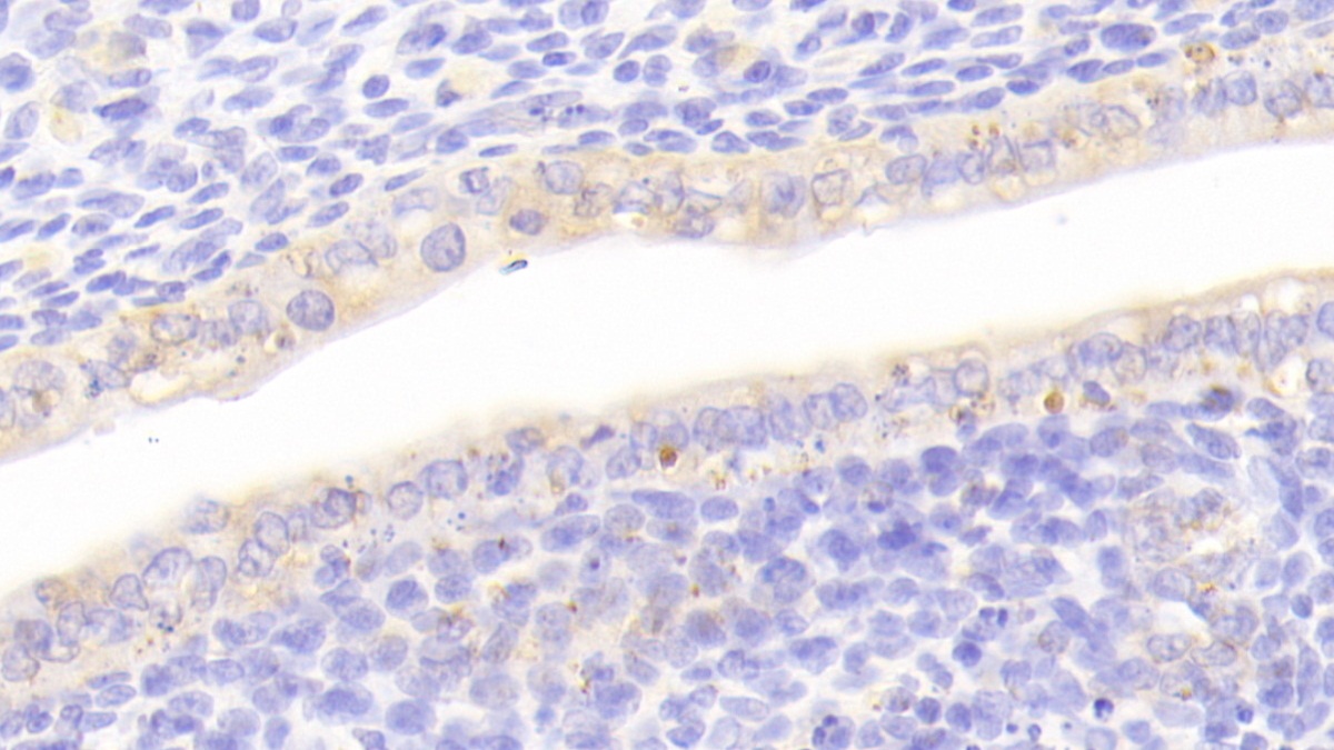 Cartilage Oligomeric Matrix Protein (COMP) Rat Polyclonal Antibody