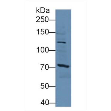 Sperm Specific Antigen 2 (SSFA2) Human Polyclonal Antibody