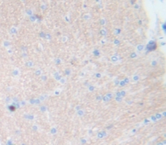Neurokinin B (NKB) Rat Polyclonal Antibody