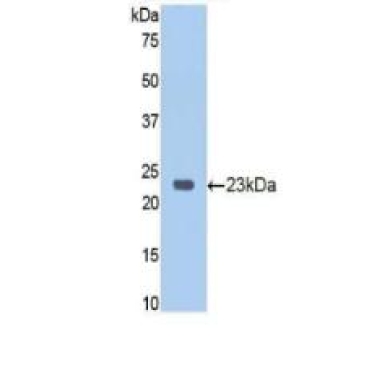 Retinoblastoma Protein 1 (RB1) Human Polyclonal Antibody