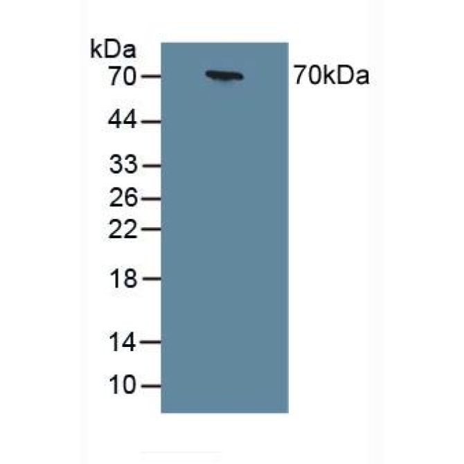 Chromogranin A (CHGA) Human Polyclonal Antibody