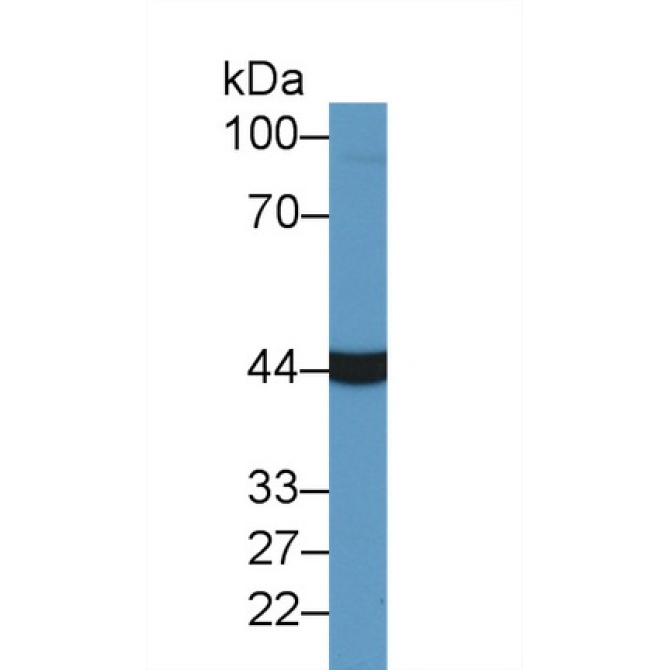 Aspartate Aminotransferase (AST) Bovine (Cattle) Polyclonal Antibody