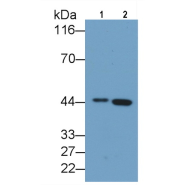 Aspartate Aminotransferase (AST) Human Polyclonal Antibody
