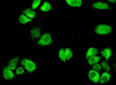 Aspartate Aminotransferase (AST) Rat Polyclonal Antibody