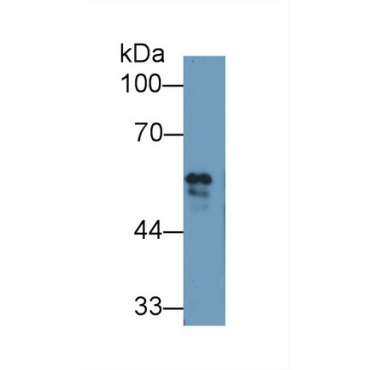 Fibrinogen Beta Chain (FGB) Bovine (Cattle) Polyclonal Antibody