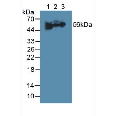 Fibrinogen Beta Chain (FGB) Human Polyclonal Antibody