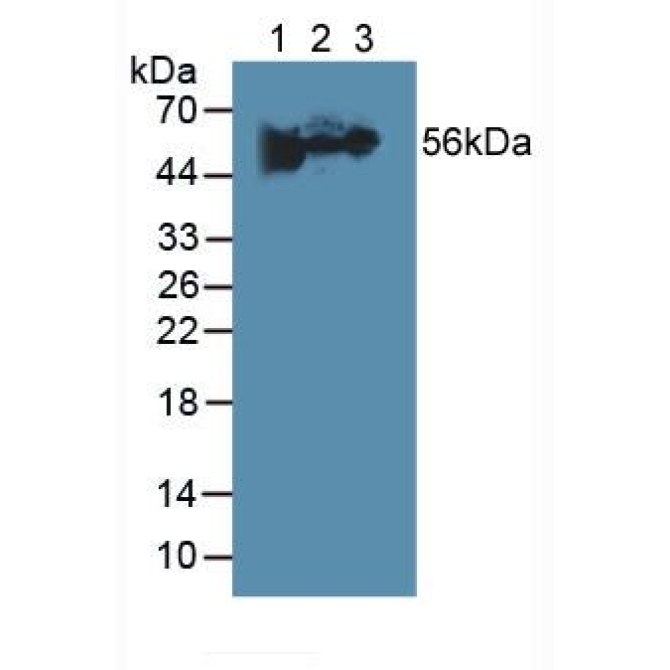 Fibrinogen Beta Chain (FGB) Human Polyclonal Antibody