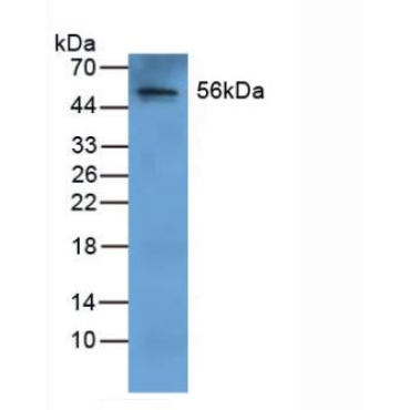 Fibrinogen Beta Chain (FGB) Human Polyclonal Antibody