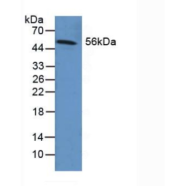 Fibrinogen Beta Chain (FGB) Human Polyclonal Antibody