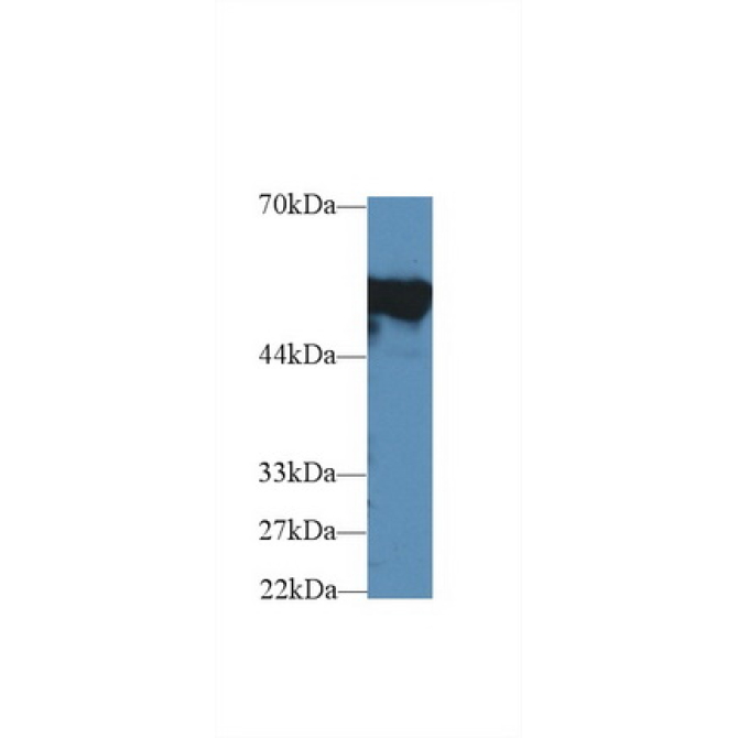 Fibrinogen Beta Chain (FGB) Mouse Polyclonal Antibody