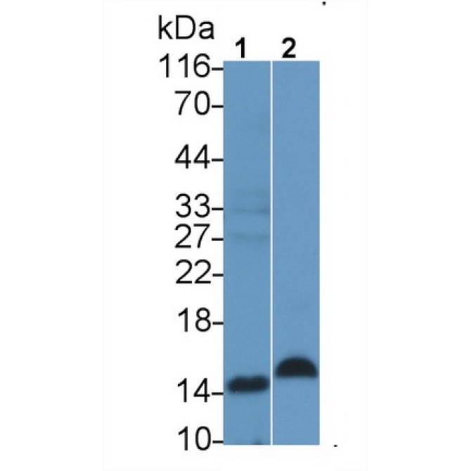 Gastrin (GT) Human Polyclonal Antibody