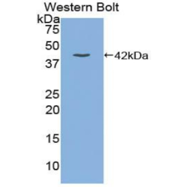 Gastrin (GT) Mouse Polyclonal Antibody